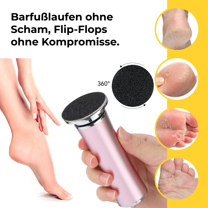 Seidenglatt Pro™ – Hornhaut-Entferner mit 60 Wechselpads (gratis)