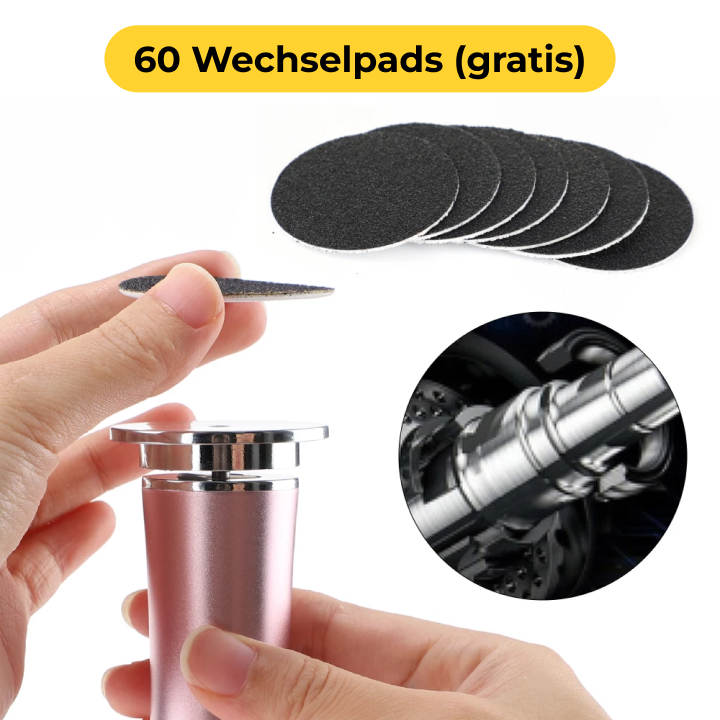 Seidenglatt Pro™ – Hornhaut-Entferner mit 60 Wechselpads (gratis)