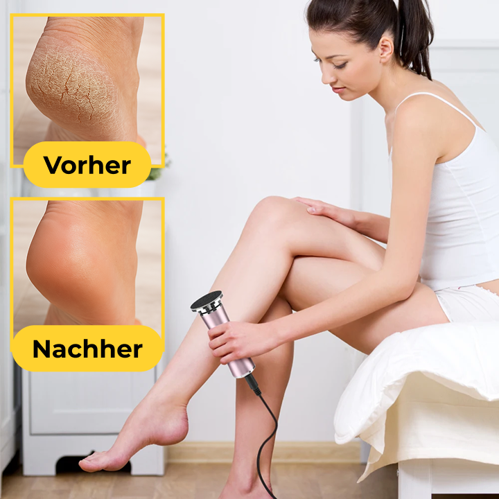 Seidenglatt Pro™ – Hornhaut-Entferner mit 60 Wechselpads (gratis)